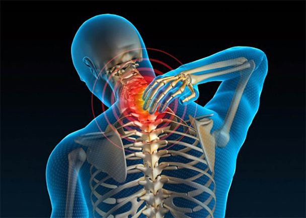 Ergonomia Factores de riesgo